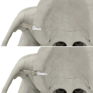 JDZygoArch Drill